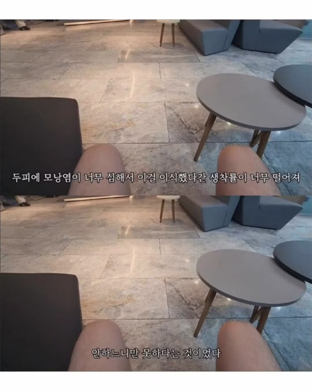 튀르키예까지 가서 모발이식 받으려다 삭발한 썰 - 인벤 인기글 이미지 4 - 밈카세