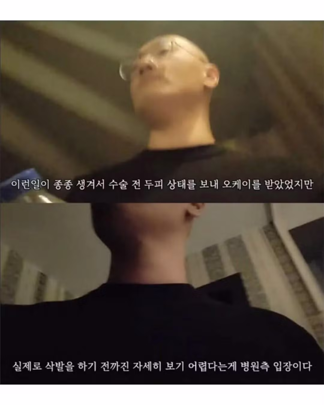 튀르키예까지 가서 모발이식 받으려다 삭발한 썰 - 인벤 인기글 이미지 5 - 밈카세