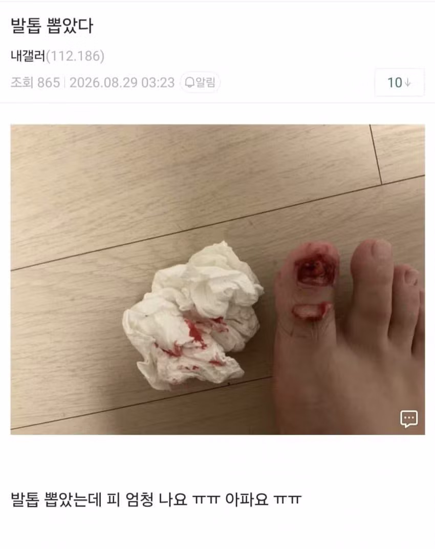 셀프로 발톱 뽑는 광기 - 인벤 인기글 이미지 3 - 밈카세