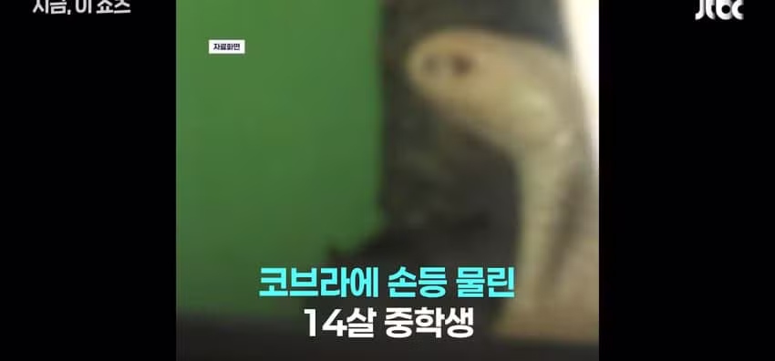 코브라 팔려다 물려서 119 신고한 중학생 - 에토랜드 인기글 이미지 2 - 밈카세