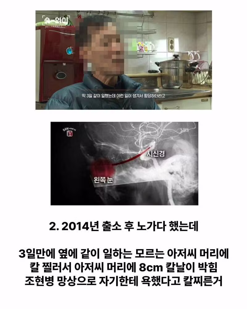 강력범죄 정신질환자들이 거리로 쏟아져 나오는 이유 - 보배드림 인기글 이미지 3 - 밈카세