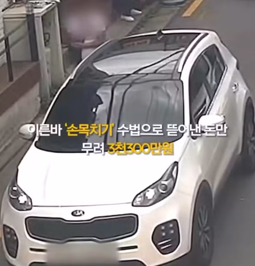 상습 보험사기범의 수법 - 보배드림 인기글 이미지 14 - 밈카세