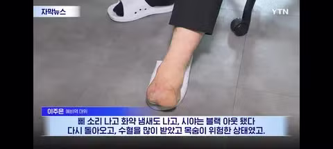 나라 지키다 발 잃었는데 증거 가져오라는 나라 - 클리앙 인기글 이미지 3 - 밈카세