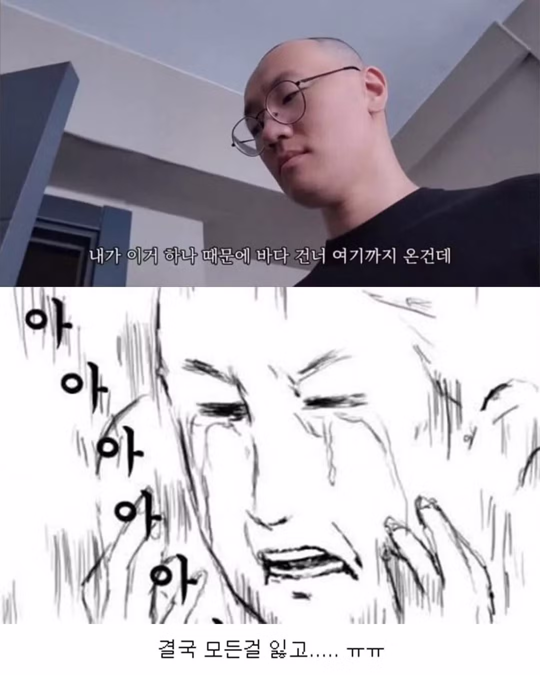 튀르키예까지 가서 모발이식 받으려다 삭발한 썰 - 인벤 인기글 이미지 6 - 밈카세