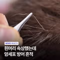 도쿄대에서 밝혀낸 흰머리의 비밀