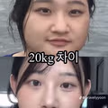 20kg 차이를 얼굴사진으로 보여주는 여자
