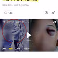 성추행 의심 받고...폭행 당한 뇌경색 앓는 70대 노인