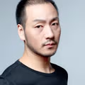 모발 이식후 초대박난 배우