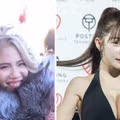 2억원치 성형결과