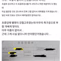 34년 동안 고환이 없는 줄 모르고 산 남자