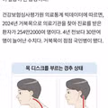 국민병으로 불리는 거북목 환자 254만 명의 현실