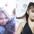 19살부터 2억원 규모로 성형한 츠자