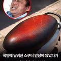 고환 부상을 입은 인도 남성