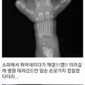 병원에 다녀온 집사네 사고뭉치 반려동물