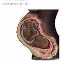 검은 태아를 본 적 없다는 주장의 황당함