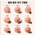 벌레 물린 자국 구별하는 방법