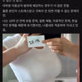 여유증 남성 사례 레전드